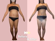 キレイサローネ 川越店(KIREI SALONE)/☆ビフォーアフターのご紹介☆