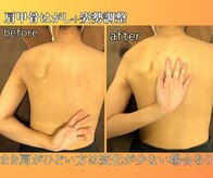 ひかる接骨院 ひかるボディケア