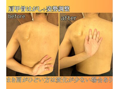 ひかる接骨院 ひかるボディケアの写真