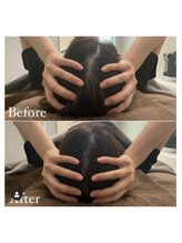 カドモリ 恵比寿代官山(KADOMORI)/頭蓋骨矯正 【小顔美容鍼】