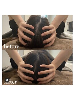 カドモリ 恵比寿代官山(KADOMORI)/頭蓋骨矯正 【小顔美容鍼】