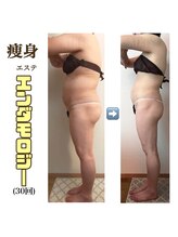 アイリス(AIRIS)/痩身/リンパケア/マッサージ