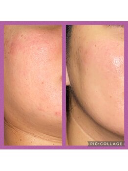 ビユ 大泉店(BIYU)/