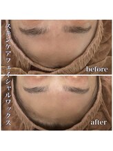 アンドナップ(nap)/額の産毛を整えて額美人♪