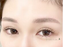 フレックル(freckle)