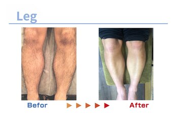 キングスサロン 熊本/メンズ足ビフォーアフター