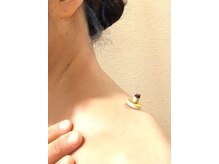 イスクラ中医鍼灸院