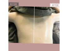 マーリエ(Malie)/【オールハンド】背中～二の腕