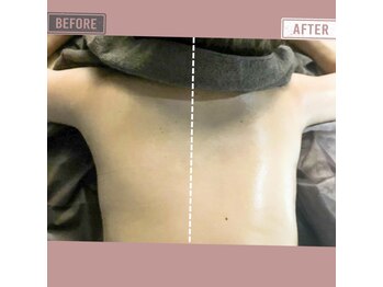 マーリエ(Malie)/【オールハンド】背中～二の腕