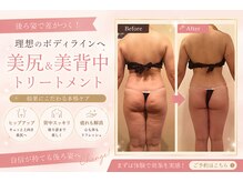 ビューティーマックス(Beauty Max)
