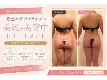 ビューティーマックス(Beauty Max)の写真/久留米唯一！エンダモロジーで何をしても痩せない下半身に本気の集中ケア。