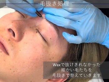 リディーブ メン 大宮(Ridive MEN)/施術の流れ5:毛抜き処理