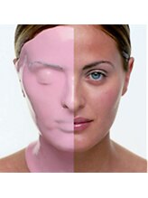 ロージィーローズ(Rosy Rose)/スペイン発☆カスマラパック