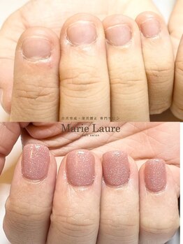 マリーロール 梅田店(Marie Laure)/自爪育成/深爪矯正/ネイルケア