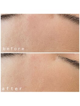 メナードフェイシャルサロン 岐阜茜部/毛穴引き締め&うるおい補給