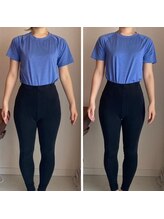 ザ エスアップ 博多店(THE S-UP)/施術前後写真