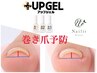 【巻き爪予防ケア】UP GEL　１コート 【親指】2本巻き爪ケア¥10000(¥11000)