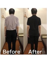 カワル整体 上通り院/右足の痺れにお困りのお客様。