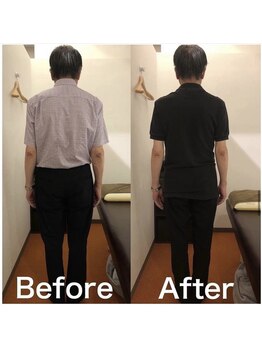 カワル整体 上通り院/右足の痺れにお困りのお客様。