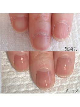 メイル(MEILU)/自爪育成