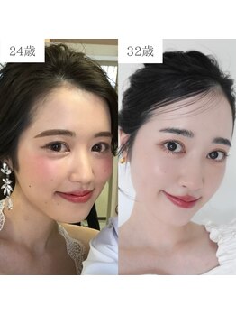 ローズ(ROSE)/8年でこの変化！