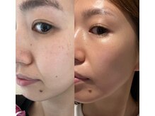 ネッコ(necco)の雰囲気（エイジングケアに特化したオリジナルメニューでマイナス10歳）