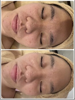 ビーカーブス 三鷹(B.curves)/before・after