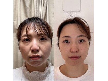 ハリドコロケン(KEN)の写真