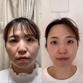 ハリドコロケン(KEN)