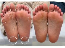 キラネイル アンド アイラッシュ by World Beauty(KIRA)/フット角質ケア