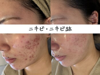 クレール(Claire)