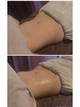 ヴァローレ(valore)/腸もみ