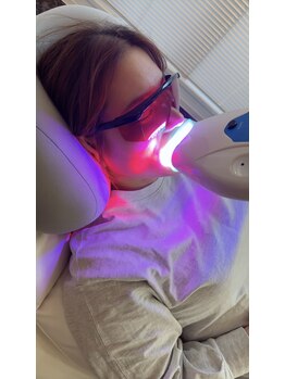 ペルラメディカルホワイトニング 名古屋/ナチュラルな白さへ