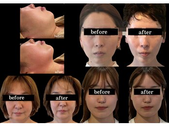 サリューベ(SALUDBE)/通う都度に立体的な小顔に近づく