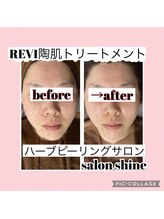 サロンシャイン(Salon Shine)/REVIハーブ３０代女性