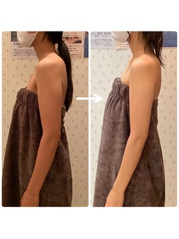 エステティックサロン ベルエトワール住吉店/肩甲骨バストアップマッサージ