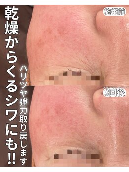 ベルファーム(Belle Femme)/目元に注目♪