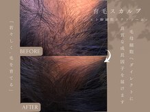 ワイビューティ(Y.Beauty)