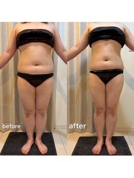 レミュービューティー(Remieux beauty)/before/after