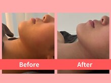 リライブ 亀有店(Re:Lives)/小顔美肌のお客様の口コミ♪