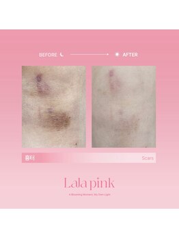 グラッソ(GRASSO)/ララピンク