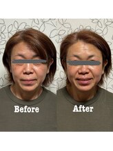 プレシャス(Precious)/肌艶トーンアップ肌質改善