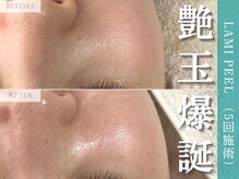 アポシェ(apoche)/艶玉/毛穴開き/透明感/ハリ/ツヤ