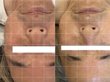 ミルジュ(MiLuJu)/レストセルトリートメント