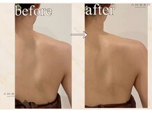 アンバー 恵比寿(AMBER)/ブライダル前にオススメ◎