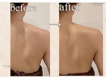 アンバー 恵比寿(AMBER)/ブライダル前にオススメ◎