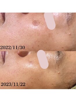 シシラ(shishira)/こんなお悩みありませんか？