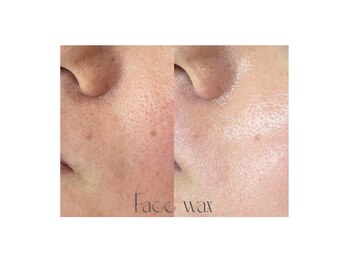 アンビアンテ　浦和店/フェイスワックス