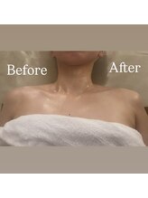 イヴトワエ(eiv Toi et A)/Before After