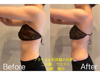 リングケー(Ling K)/ブライダルエステ